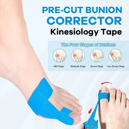 🔥 60PCS Pre-Cut Bunion Correction Kinesiology Tape – Elastic, Breathable & Hypoallergenic Latex-Free Toe Support Strips, Waterproof Adhesive Foot Patch for Hallux Valgus Pain Relief & Toe Alignment (One Size Fits All)