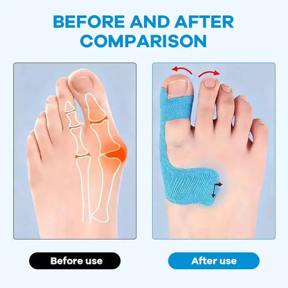 🔥 60PCS Pre-Cut Bunion Correction Kinesiology Tape – Elastic, Breathable & Hypoallergenic Latex-Free Toe Support Strips, Waterproof Adhesive Foot Patch for Hallux Valgus Pain Relief & Toe Alignment (One Size Fits All)